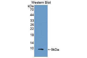 Western blot analysis of the recombinant protein. (CXCL2 anticorps  (AA 34-107))