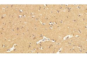 Detection of TXNIP in Human Cerebrum Tissue using Polyclonal Antibody to Thioredoxin-interacting Protein (TXNIP)