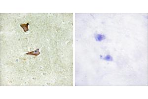 Immunohistochemistry analysis of paraffin-embedded human brain tissue using IGF2R (Phospho-Ser2409) antibody. (IGF2R anticorps  (pSer2409))