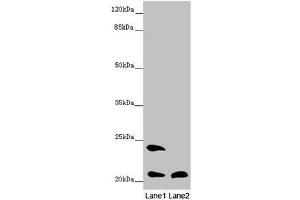 Western blot All lanes: MSRB3 antibody at 8. (MSRB3 anticorps  (AA 1-185))