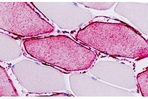 Human Skeletal Muscle: Formalin-Fixed, Paraffin-Embedded (FFPE) (ATP2A1/SERCA1 anticorps  (AA 548-597))