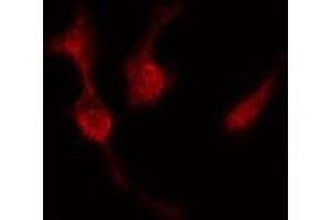 ABIN6277519 staining  Hela cells by IF/ICC. (PRKACB anticorps  (C-Term))