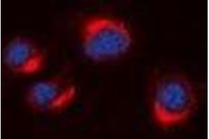 Immunofluorescent analysis of VN1R2 staining in A549 cells. (VN1R2 anticorps)