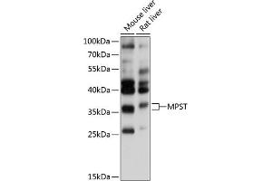 Western blot analysis of extracts of various cell lines, using MPST antibody (ABIN6128242, ABIN6143974, ABIN6143976 and ABIN6215272) at 1:1000 dilution. (MPST anticorps  (AA 30-170))