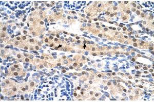 Human kidney (SULF2 anticorps  (C-Term))