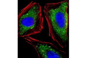Immunofluorescent analysis of 4 % paraformaldehyde-fixed, 0.