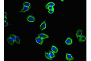 Immunofluorescent analysis of A375 cells using ABIN7149074 at dilution of 1:100 and Alexa Fluor 488-congugated AffiniPure Goat Anti-Rabbit IgG(H+L)