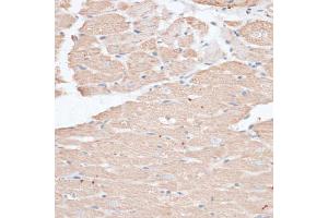 Immunohistochemistry of paraffin-embedded rat heart using ABCC5 antibody (ABIN6291734) at dilution of 1:100 (40x lens). (ABCC5 anticorps)