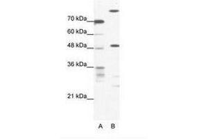 Image no. 1 for anti-NFS1, Cysteine Desulfurase (NFS1) (AA 151-200) antibody (ABIN202565) (NFS1 anticorps  (AA 151-200))