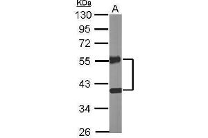 WB Image Sample (20 ug of whole cell lysate) A: Mouse brain 10% SDS PAGE antibody diluted at 1:10000