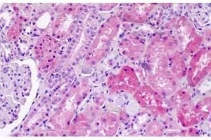 Human Kidney: Formalin-Fixed, Paraffin-Embedded (FFPE)
