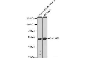 Western blot analysis of extracts of various cell lines using Gm13125 Polyclonal Antibody at dilution of 1:1000. (Pramel15 anticorps)