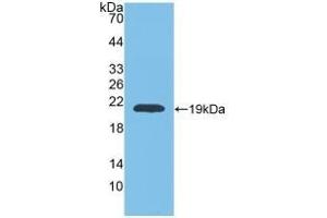 Detection of Recombinant MMP9, Rat using Polyclonal Antibody to Matrix Metalloproteinase 9 (MMP9)