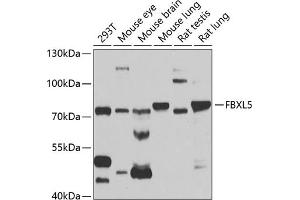 Western blot analysis of extracts of various cell lines, using FBXL5 antibody (ABIN6130378, ABIN6140510, ABIN6140511 and ABIN6221239) at 1:1000 dilution. (FBXL5 anticorps  (AA 1-310))