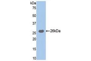 WB of Protein Standard: different control antibodies against Native TRY protein.