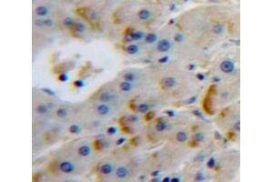 Used in DAB staining on fromalin fixed paraffin-embedded Liver tissue (FURIN anticorps  (AA 385-500))