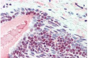 Human Breast (formalin-fixed, paraffin-embedded) stained with SFRS1 antibody ABIN461956 at 10 ug/ml followed by biotinylated anti-mouse IgG secondary antibody ABIN481714, alkaline phosphatase-streptavidin and chromogen.