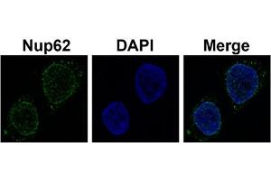 Sample Type :  Hela cell lysate (NUP62 anticorps  (N-Term))