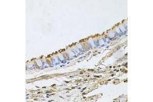 Immunohistochemistry of paraffin-embedded human lung using HSP90AA1 antibody (ABIN6292998) at dilution of 1:100 (40x lens). (HSP90AA1 anticorps)