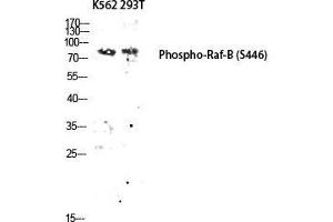 Western Blot (WB) analysis of K562 293T lysis using Phospho-Raf-B (S446) antibody. (BRAF anticorps  (pSer446))