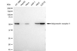 Western blotting analysis using Adiponectin receptor 1 antibody (ABIN7797529). (Recombinant Adiponectin Receptor 1 anticorps)