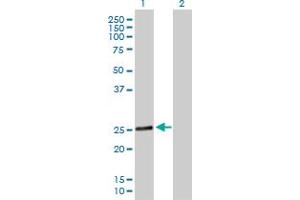 Western Blot analysis of RAB28 expression in transfected 293T cell line by RAB28 MaxPab polyclonal antibody. (RAB28 anticorps  (AA 1-221))