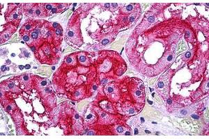 Human Kidney, Tubules: Formalin-Fixed, Paraffin-Embedded (FFPE)