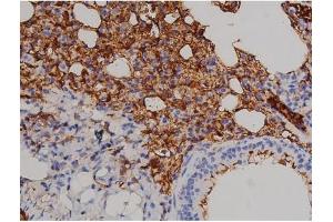 ABIN6267521 at 1/200 staining Mouse lung1.