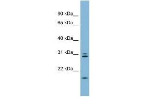 WB Suggested Anti-ANAPC10 Antibody Titration:  0. (ANAPC10 anticorps  (N-Term))