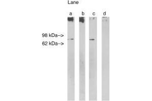 Image no. 1 for anti-Ceramide Synthase 1 (CERS1) antibody (ABIN265223) (LASS1 anticorps)