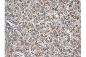 Immunohistochemical staining of paraffin-embedded Human colon tissue using anti-PDE4A mouse monoclonal antibody. (PDE4A anticorps)