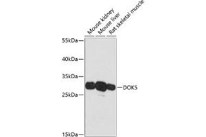 Western blot analysis of extracts of various cell lines, using DOK5 antibody (ABIN6127774, ABIN6139769, ABIN6139770 and ABIN6217826) at 1:3000 dilution.