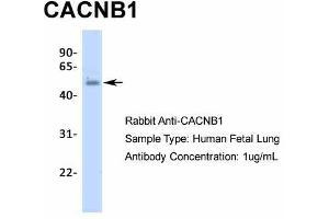 Host:  Rabbit  Target Name:  CACNB1  Sample Type:  Human Fetal Lung  Antibody Dilution:  1. (CACNB1 anticorps  (N-Term))