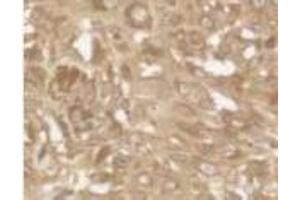 Image no. 1 for anti-BCL2 Binding Component 3 (BBC3) (AA 186-199) antibody (ABIN208703)