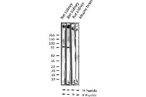 Western blot analysis of Phospho-C-RAF (Ser259) expression in various lysates (RAF1 anticorps  (pSer259))