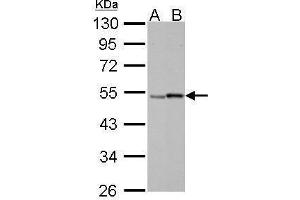 WB Image Retinoic Acid Receptor gamma antibody detects RARG protein by Western blot analysis.