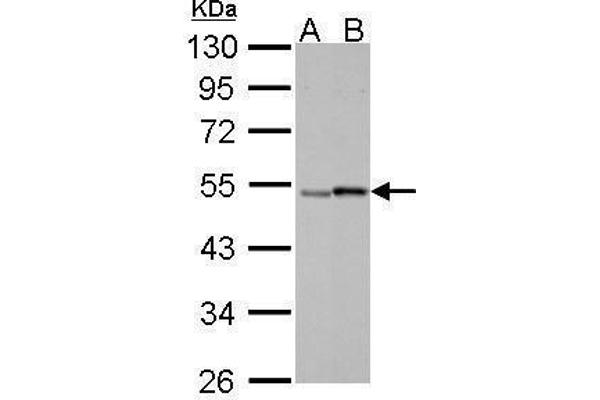 Retinoic Acid Receptor gamma anticorps