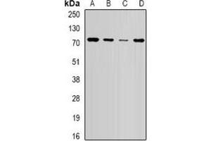 Western blot analysis of NSD2 expression in HepG2 (A), SW620 (B), mouse brain (C), mouse spleen (D) whole cell lysates. (WHSC1 anticorps)