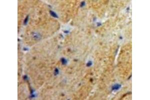 Used in DAB staining on fromalin fixed paraffin-embedded Heart tissue (MSE anticorps  (AA 3-434))