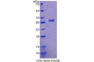 SDS-PAGE (SDS) image for Myeloid Cell Nuclear Differentiation Antigen (MNDA) (AA 189-405) protein (His tag) (ABIN2125985) (MNDA Protein (AA 189-405) (His tag))