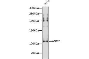 Western blot analysis of extracts of HeLa cells, using  antibody (ABIN6129704, ABIN6136903, ABIN6136905 and ABIN6216979) at 1:3000 dilution. (Anoctamin 2 anticorps  (AA 1-200))