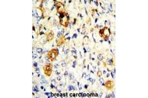 Immunohistochemistry (IHC) image for anti-Matrix Metallopeptidase 19 (MMP19) antibody (ABIN3002548)