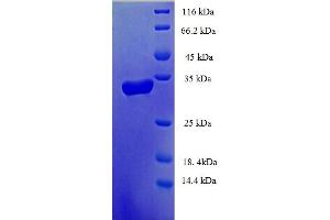 SDS-PAGE (SDS) image for Chromosome 14 Open Reading Frame 126 (C14orf126) (AA 1-168), (full length) protein (His-SUMO Tag) (ABIN5711648)