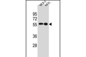 SRC Antibody (N-term) A western blot analysis in MCF-7,A431 cell line lysates (35 μg/lane). (Src anticorps  (N-Term))