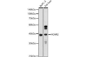 Western blot analysis of extracts of various cell lines, using GPR109A/HM74A/HC antibody (ABIN7267804) at 1:1000 dilution. (HCAR2 anticorps  (AA 250-350))