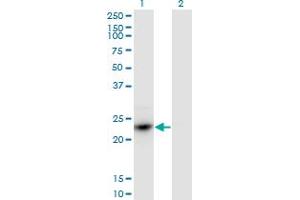 Western Blot analysis of HDGFRP3 expression in transfected 293T cell line by HDGFRP3 monoclonal antibody (M02), clone 1D1. (HDGFRP3 anticorps  (AA 1-203))