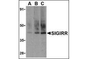 Western blot analysis of SIGIRR in A549 cell lysate with this product at (A) 0. (SIGIRR anticorps  (C-Term))