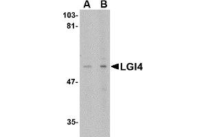 Western Blotting (WB) image for anti-Leucine-Rich Repeat LGI Family, Member 4 (LGI4) (C-Term) antibody (ABIN1030480)