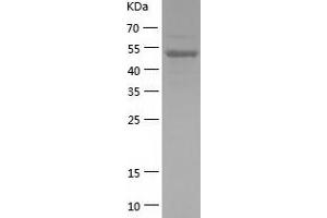 Western Blotting (WB) image for Bromodomain Containing 2 (BRD2) (AA 1-455) protein (His-IF2DI Tag) (ABIN7122048)