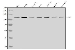 Western blot analysis of NLRP3 using anti-NLRP3 antibody (ABIN7602532).